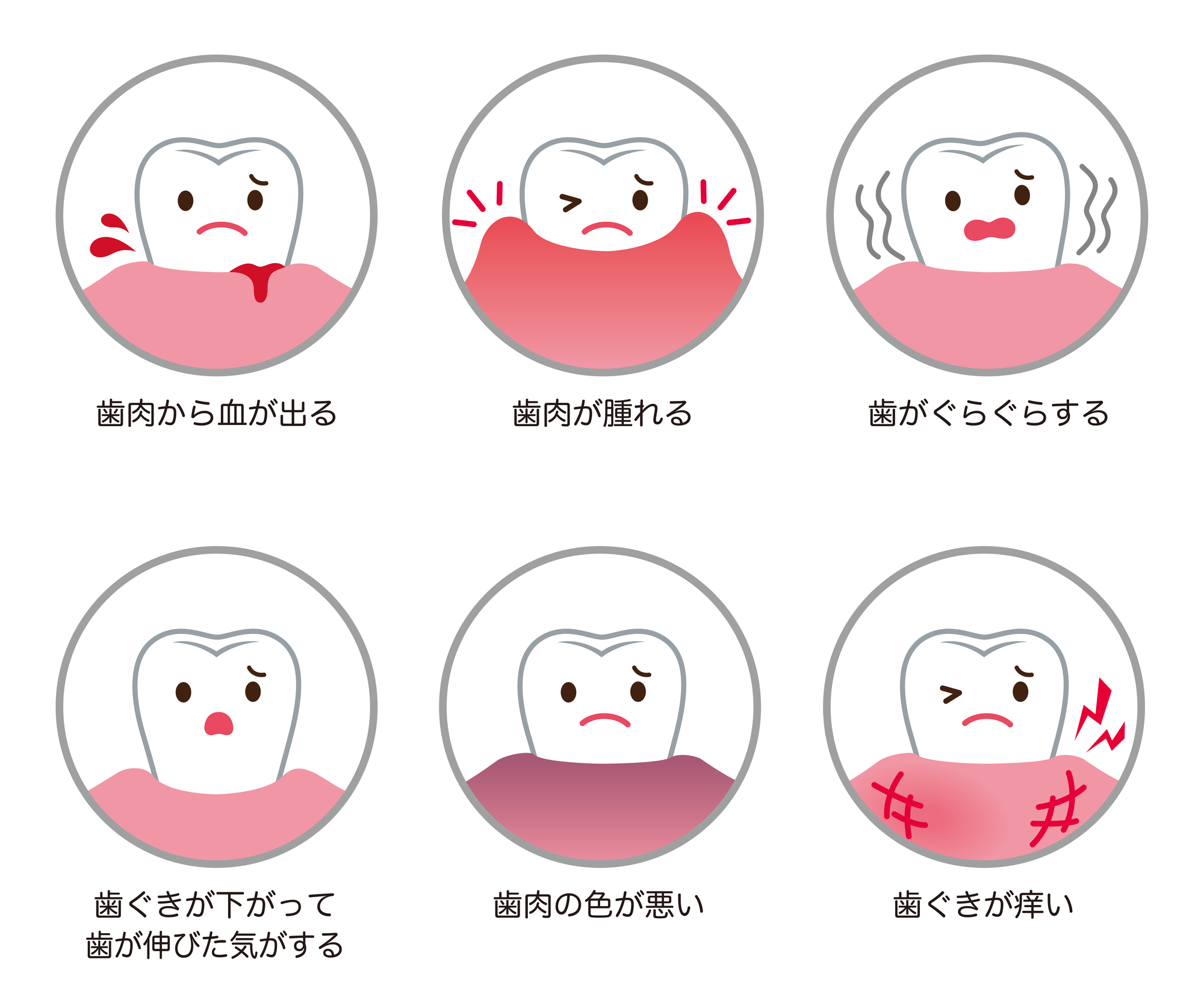 歯 が ぐらつく 噛む と 痛い